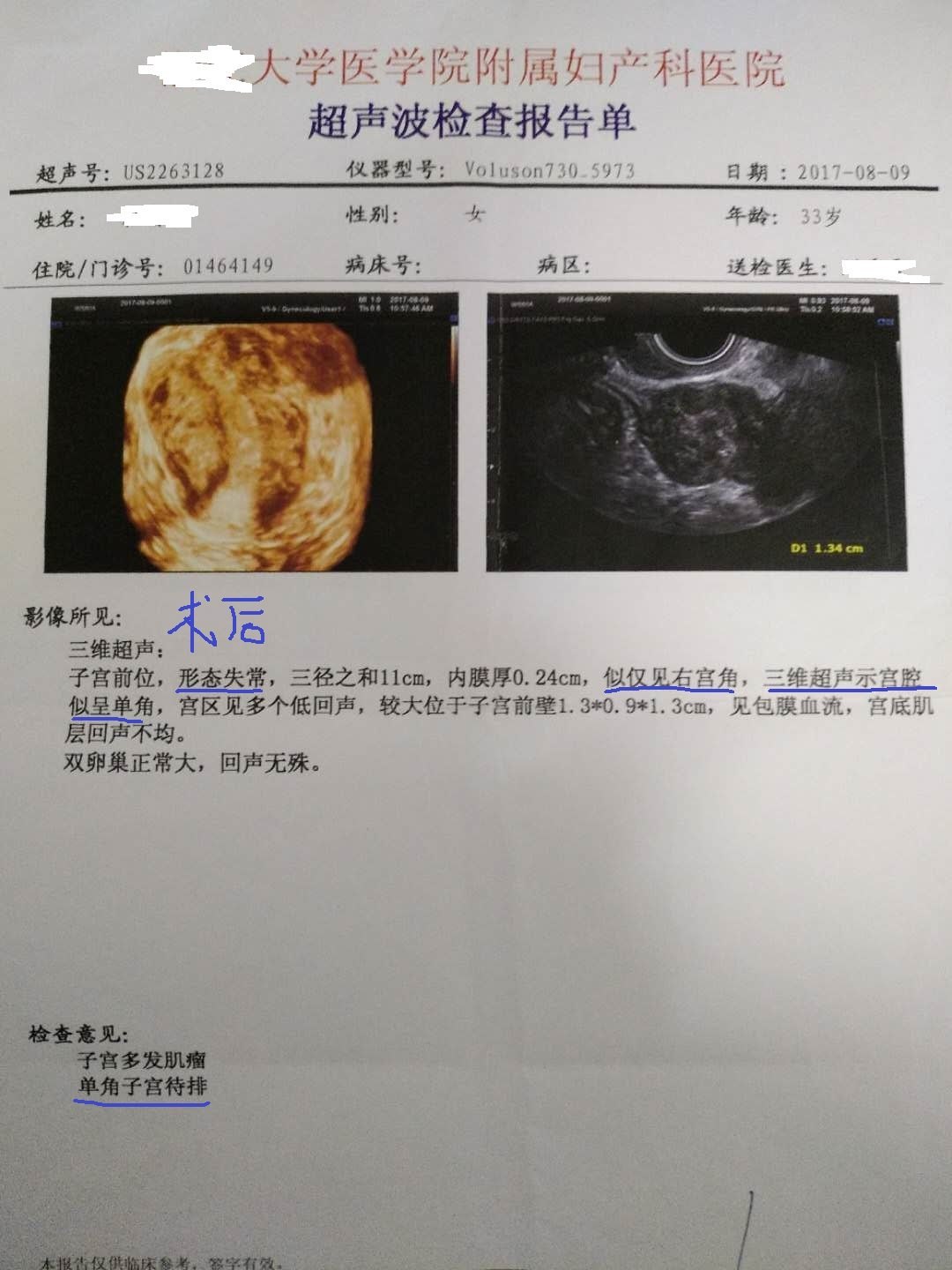 子宫肌瘤手术多长时间可以怀孕,子宫肌瘤手术恢复时间与怀孕规划，整体规划执行讲解及复古款时尚解读,高速方案规划_iPad88.40.57