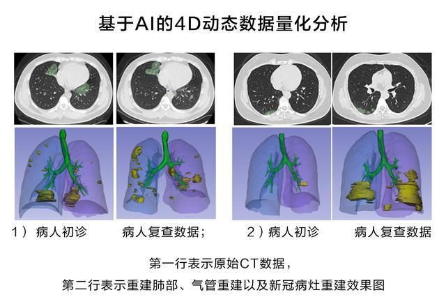 ct人工智能诊断什么原理