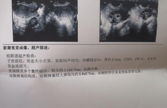 卵泡发育不成熟会怀孕吗