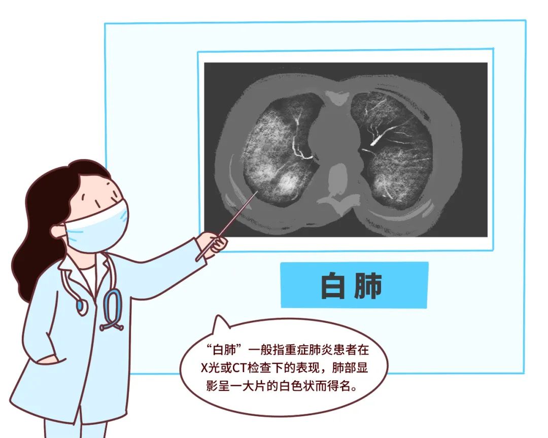 甲流偏爱肥胖病人合并可导致白肺